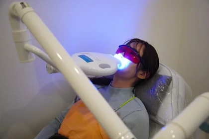 オフィスホワイトニングの特徴